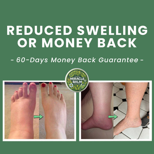 Miracle Balm