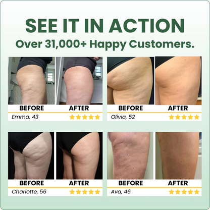 Additional Anti-Cellulite Massage Oil