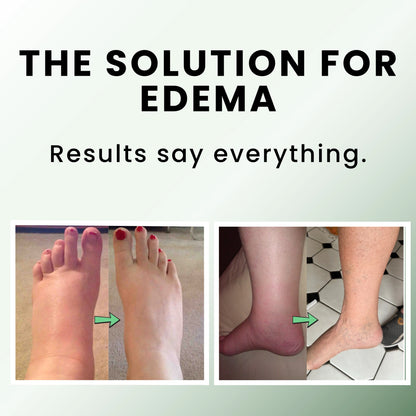 Sorviq™ Miracle Balm