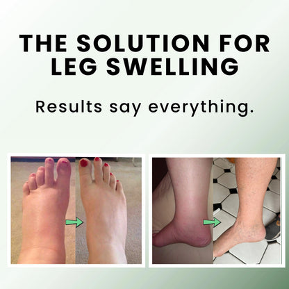 Sorviq Miracle Balm