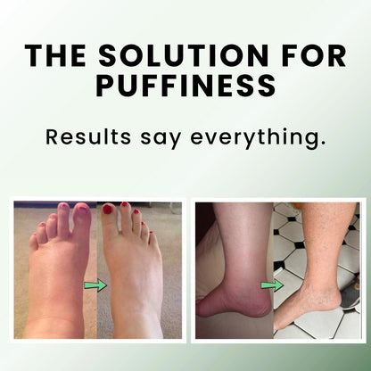 Sorviq™ Miracle Balm