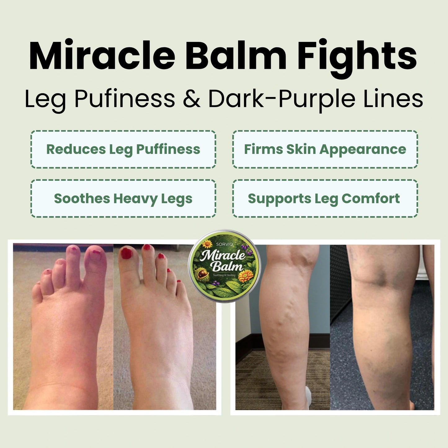 Sorviq™ Miracle Balm