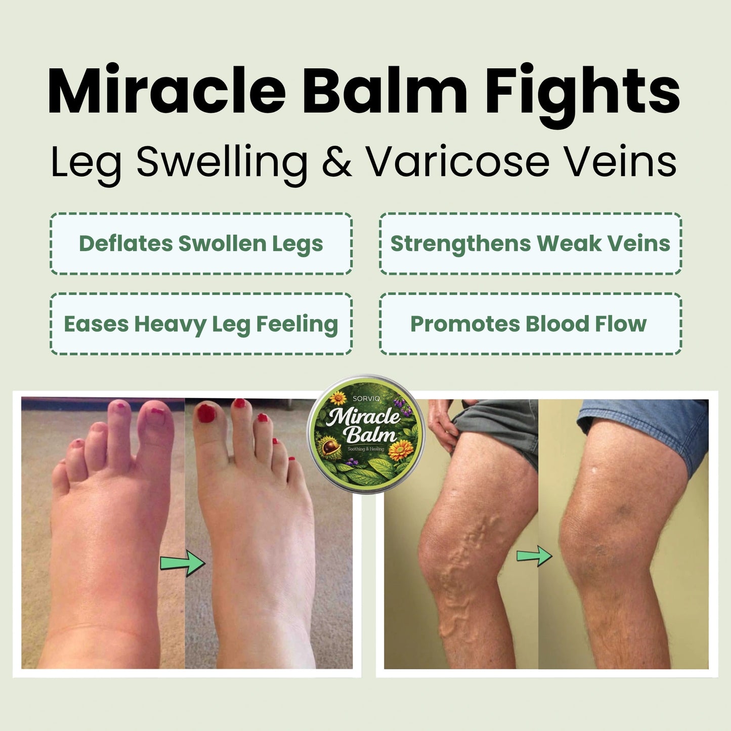 Sorviq Miracle Balm