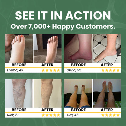2x Additional Miracle Balms