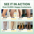 Sorviq™ Miracle Balm NEW - TEST