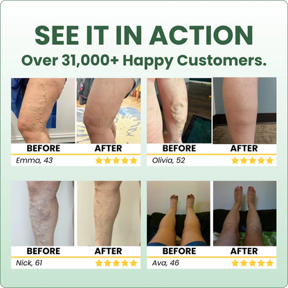 Sorviq™ Miracle Balm Spring