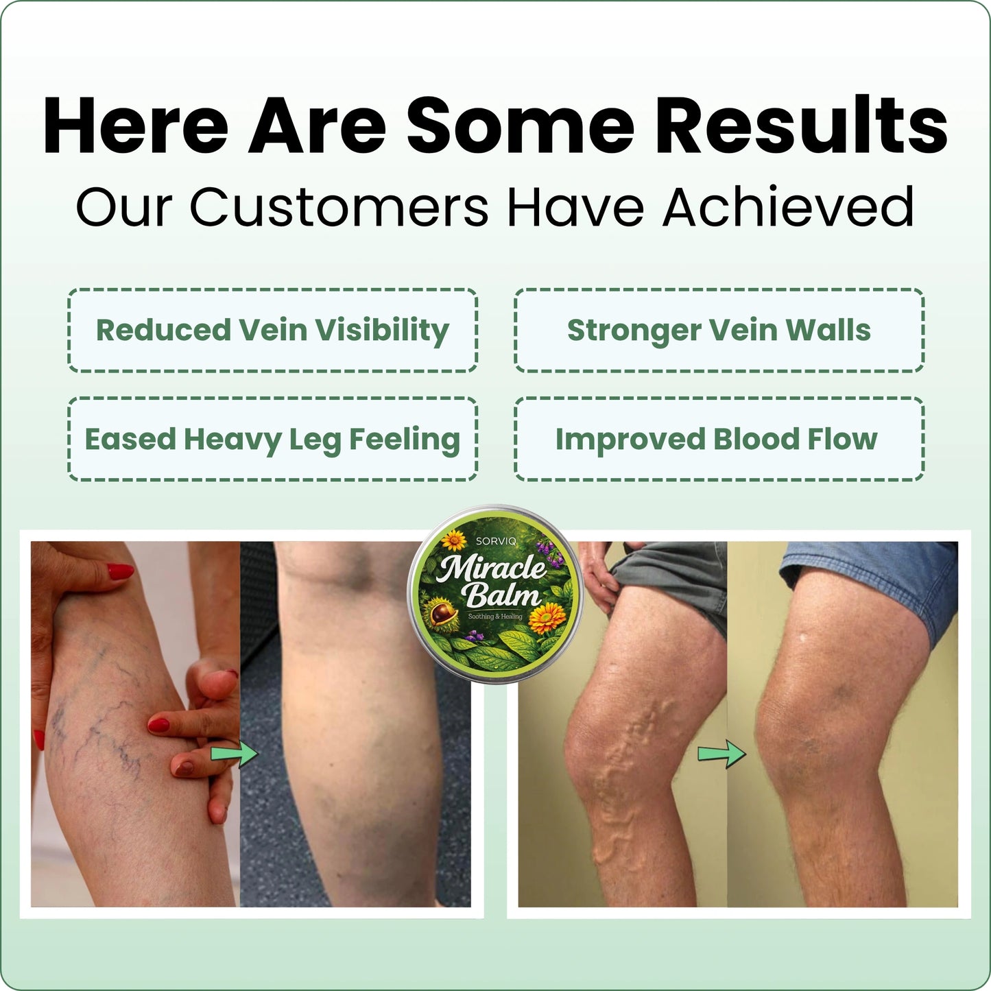 Sorviq™ Miracle Balm Spring